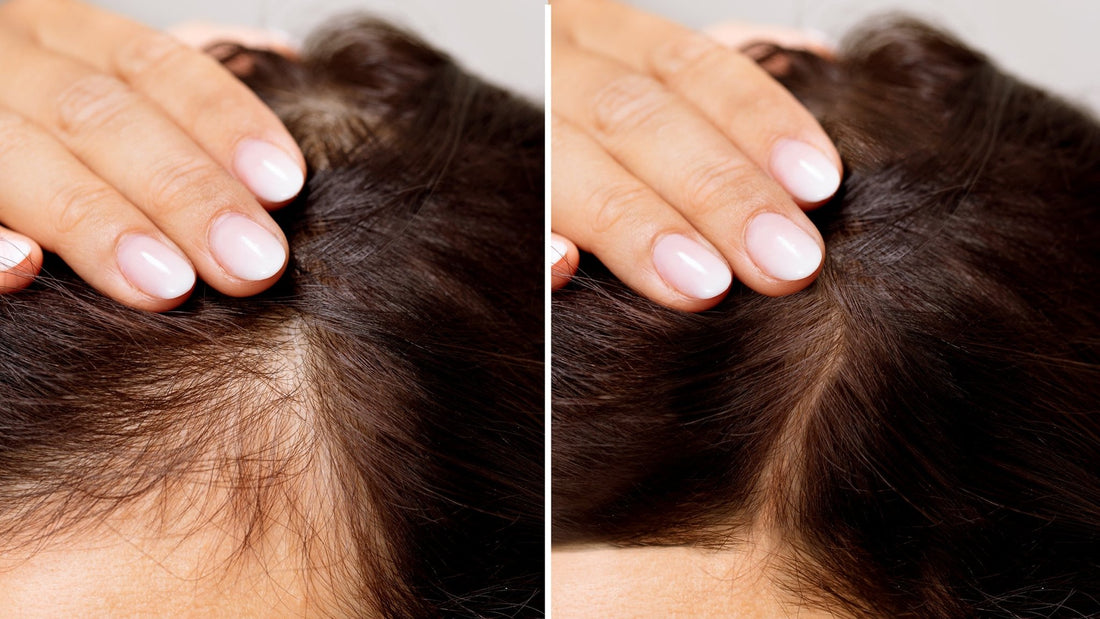 The Best Foods for Hair Growth & Prevent Hair Fall