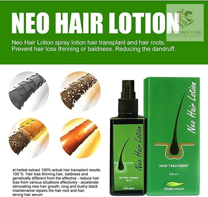 Neo Hair Lotion with Derma Roller, Hair Treatment & Root Nutrients, 120ml