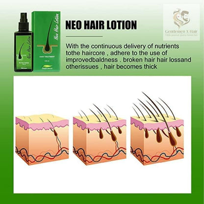 Neo Hair Lotion with Derma Roller, Hair Treatment & Root Nutrients, 120ml
