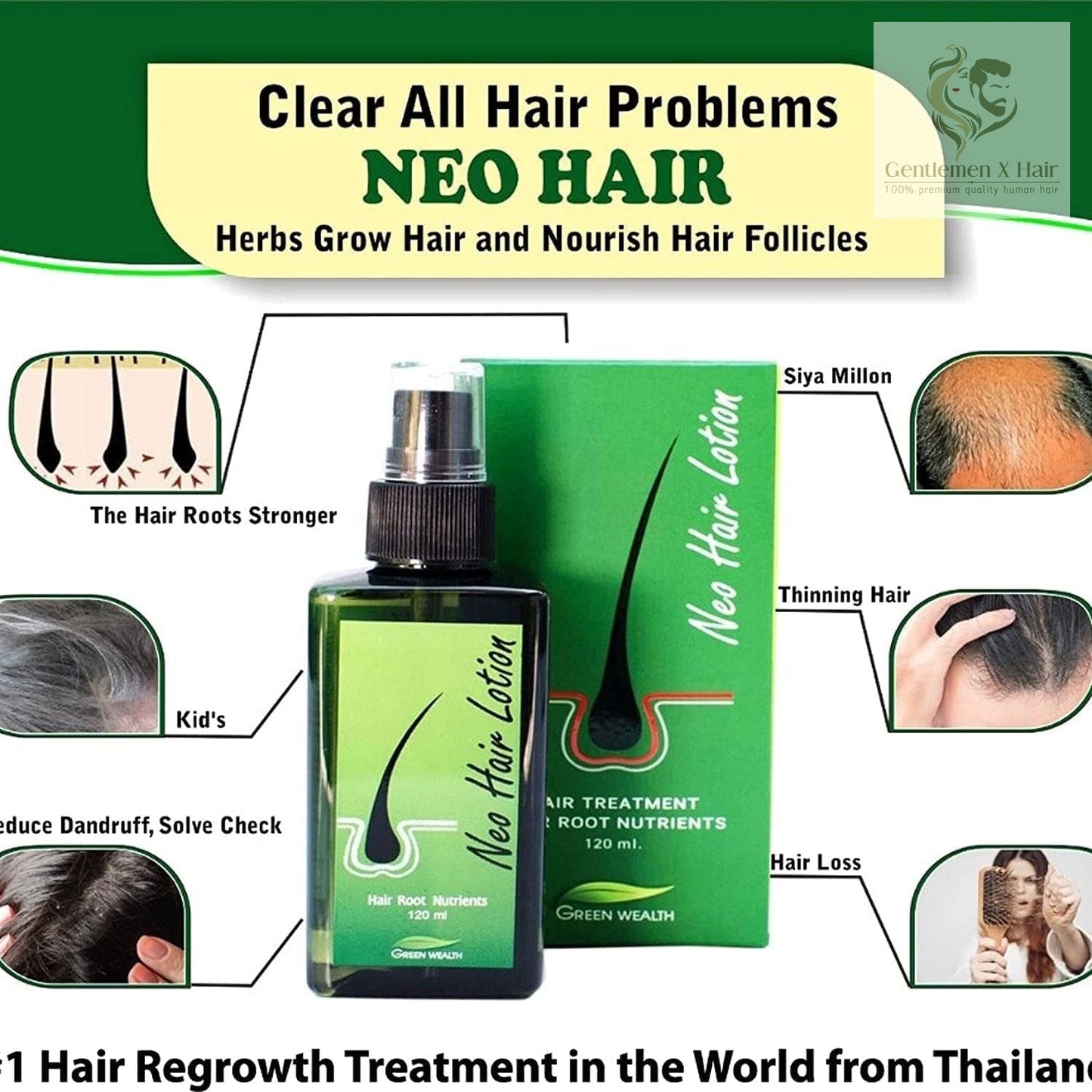 Neo Hair Lotion with Derma Roller, Hair Treatment & Root Nutrients, 120ml