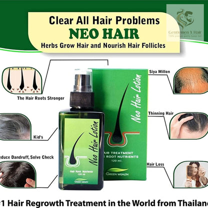 Neo Hair Lotion with Derma Roller, Hair Treatment & Root Nutrients, 120ml